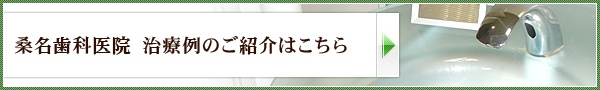 桑名歯科医院　治療例のご紹介はコチラ
